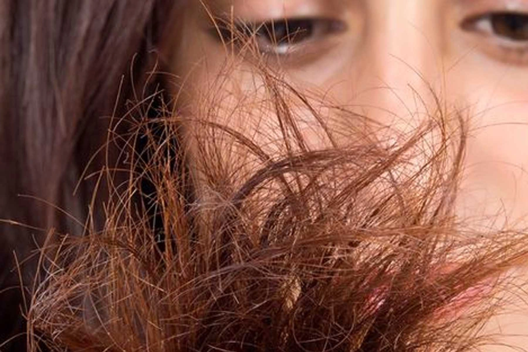 Fragile-Hair Fragile Hair
