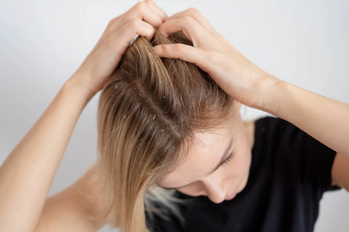 Scalp Problem Solutions