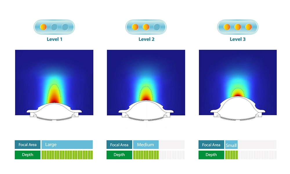 Electromagnetic Focused Shockwave Therapy Device