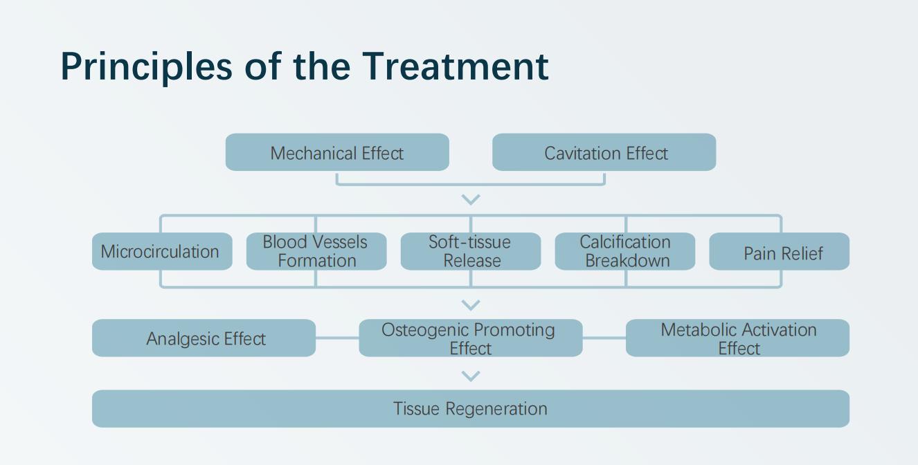 Extracorporeal Shock Wave Therapy，ESWT
