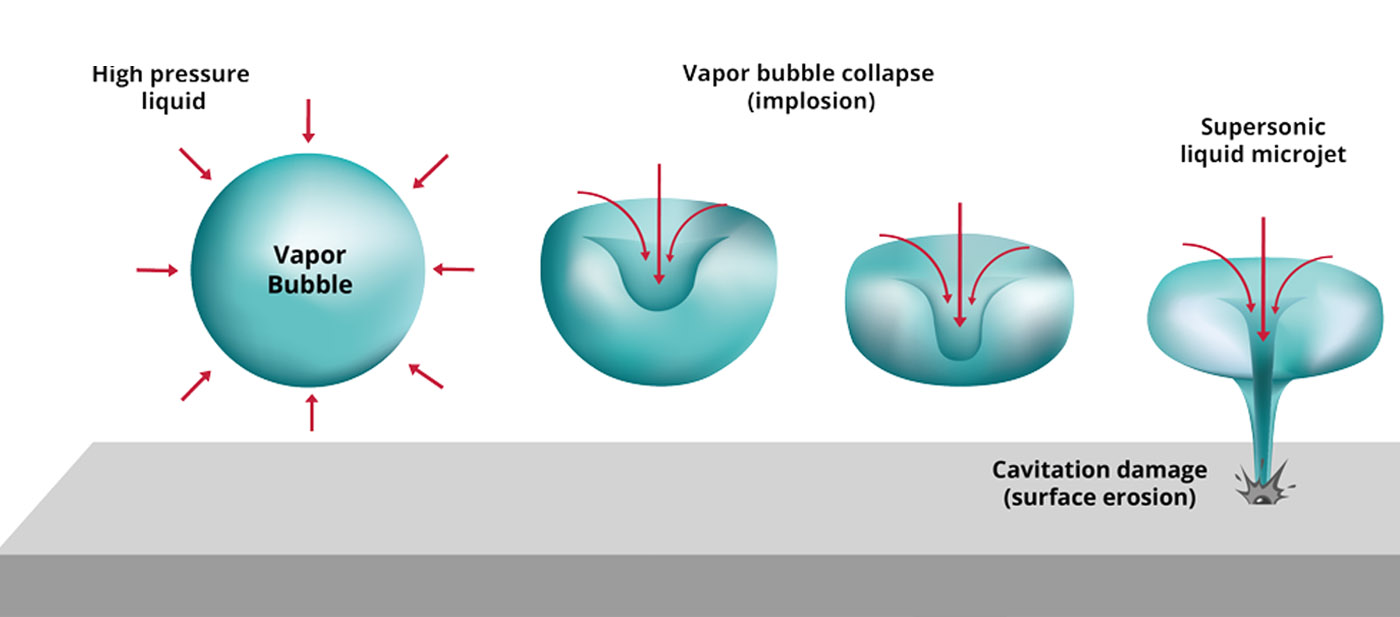 Focused Shock Wave Therapy (6)
