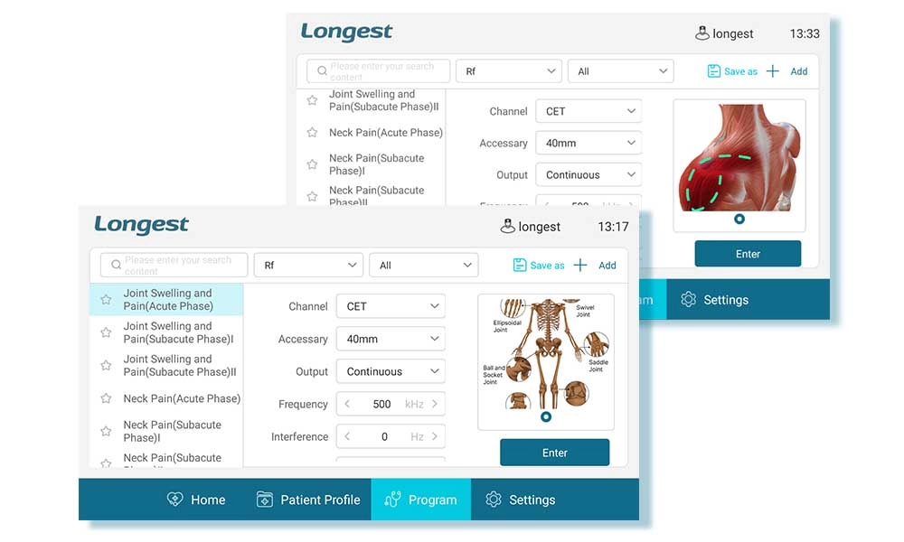 Intuitive Protocol Management