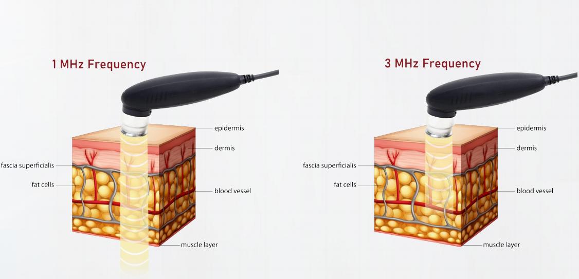 Longest Ultrasound