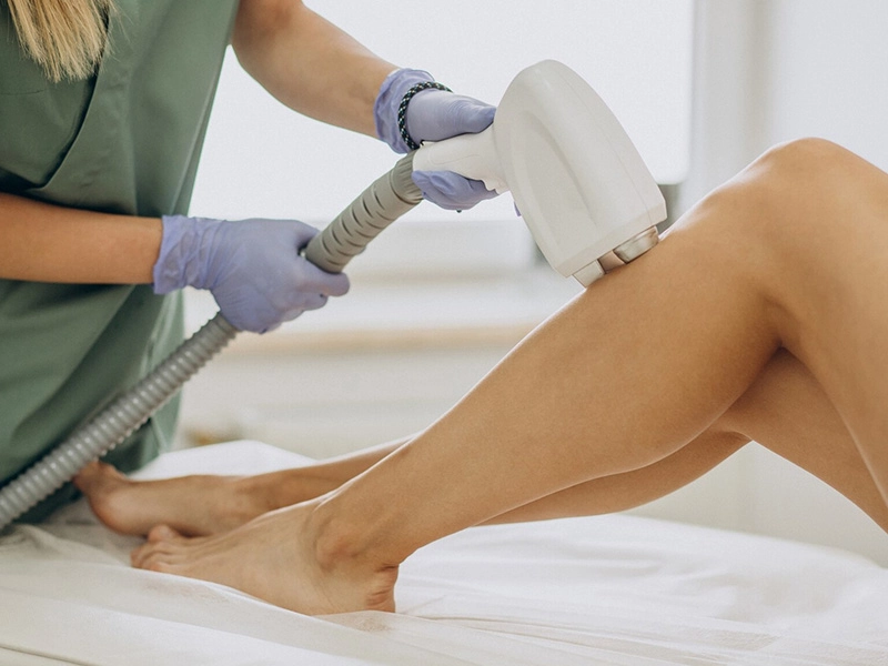 HAIR REMOVAL TECHNOLOGIES