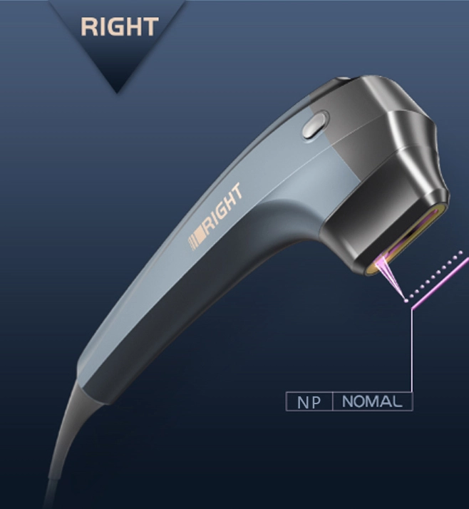 3d hifu machine