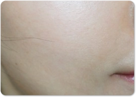 after after