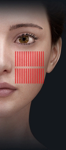 8-in-1-hydra-facial-machine 8 in 1 hydra facial machine