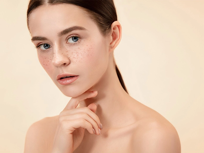 Pigmentation Removal