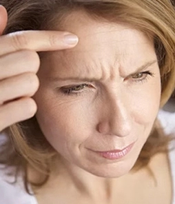 SKIN LAXITY