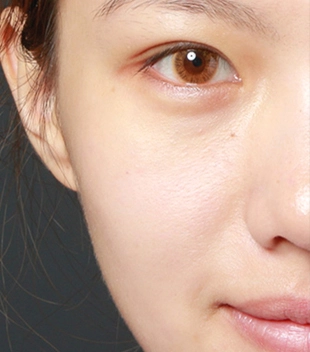 china hifu facial machine
