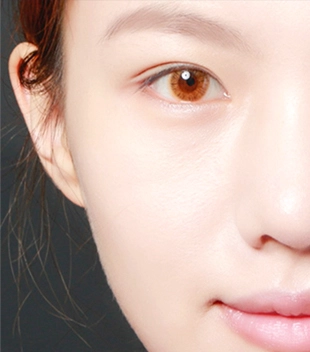 china hifu in anti-wrinkle machine