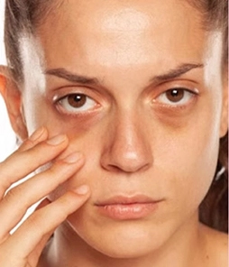 DARK-SPOTS DARK SPOTS