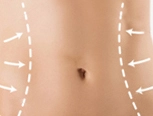 how much is a laser hair removal machine