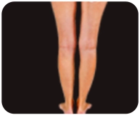 Lowerlegs