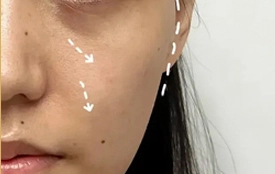 hydra-facial-machine-price hydra facial machine price