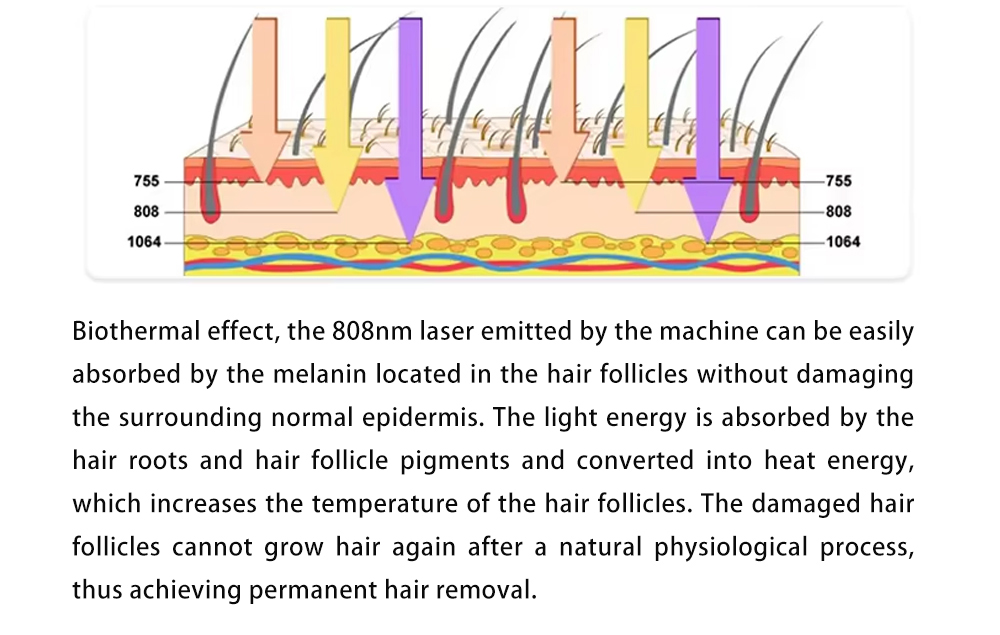 L6 laser hair removal machine 55 L6 laser hair removal machine 55
