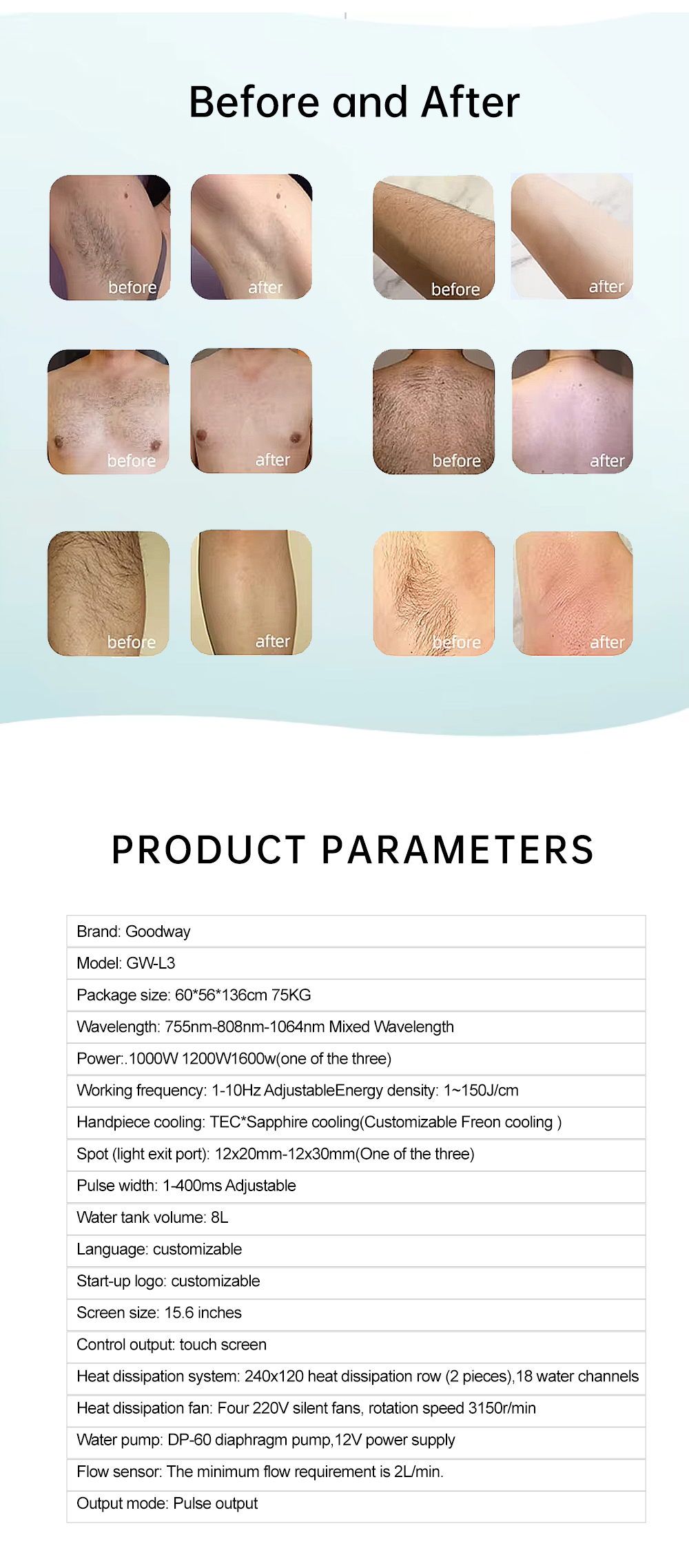 L7 Laser Hair Removal Machine 99 L7 Laser Hair Removal Machine 99