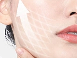 professional hair removal laser machine