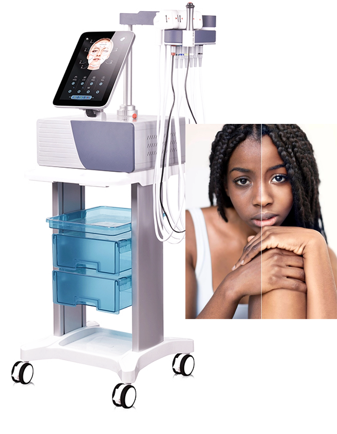 Top Rated EMS Face Massagers for Youthful Skin for Face, Neck, and Body Sculpting