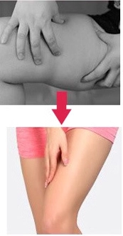 ultra cavitation machine reviews