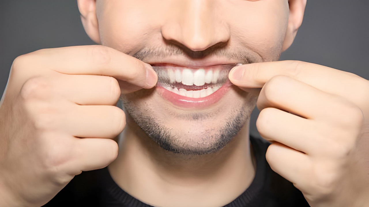 meilleures bandes de blanchiment des dents