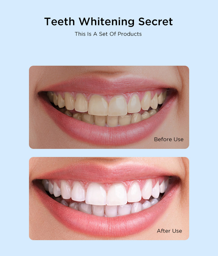 A close-up of a person's teeth before and after using a teeth whitening product. The teeth are stained yellow before using the product and white after using it.