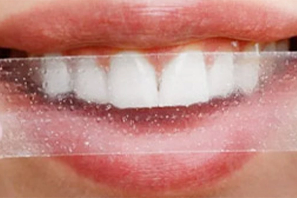 A close-up image of a person smiling with a teeth-whitening strip on their teeth.