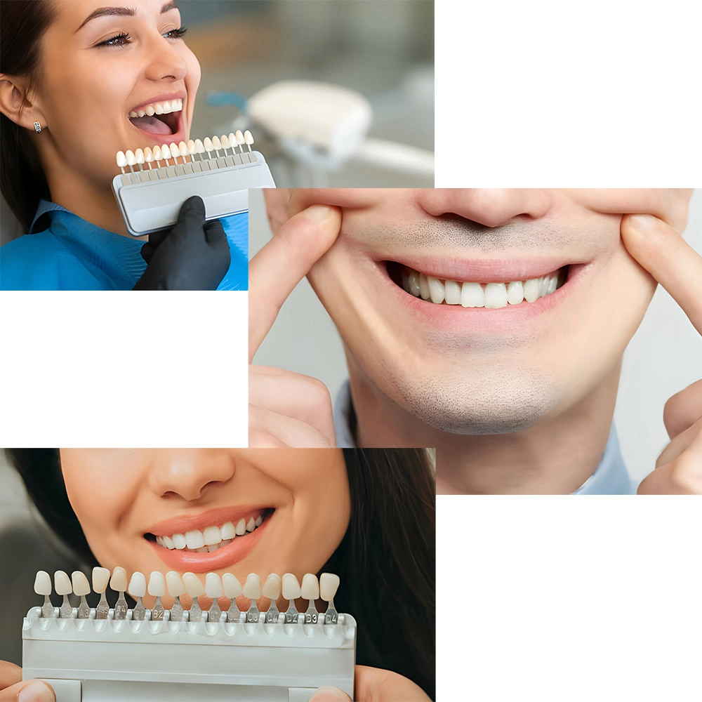 The image shows a woman and a man smiling with their teeth whitened. The woman is holding a shade guide to show different teeth shades.