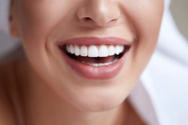 best gentle teeth whitening