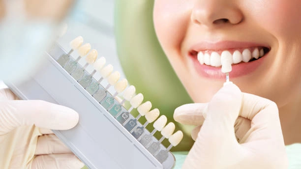 Le meilleur blanchiment des dents pour les gencives sensibles. Le nuancier présente les options.