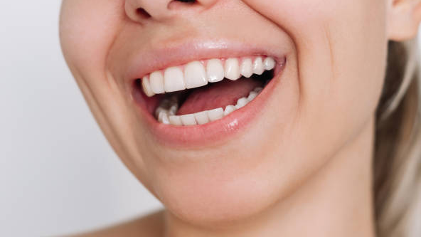 Bright smile showcasing teeth whitening supplies wholesale.