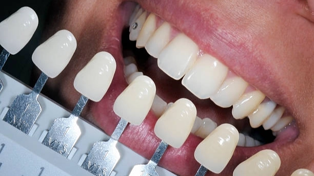 Best whitening gel shades shown against teeth.