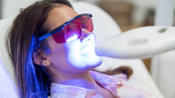 Laser Teeth Whitening