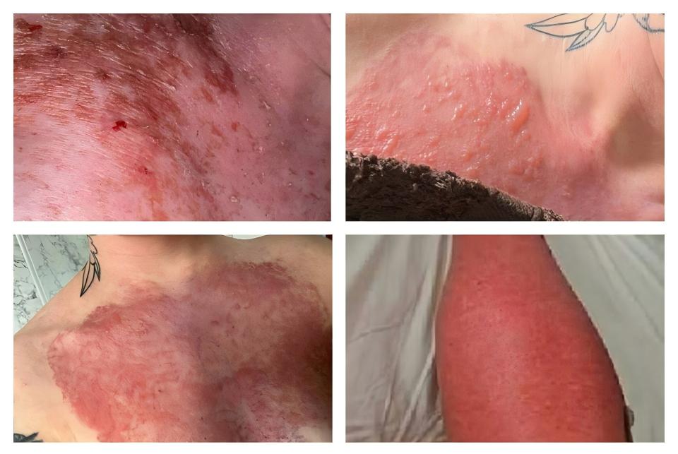 tktx numbing cream tktx numbing cream