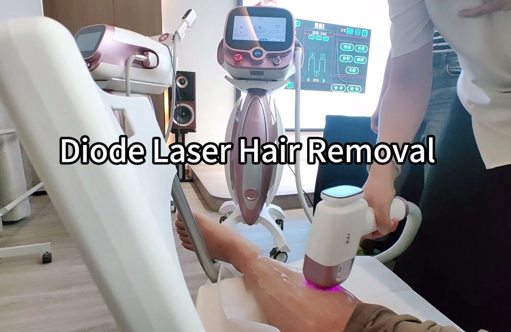 laser-hair-removal-treatment