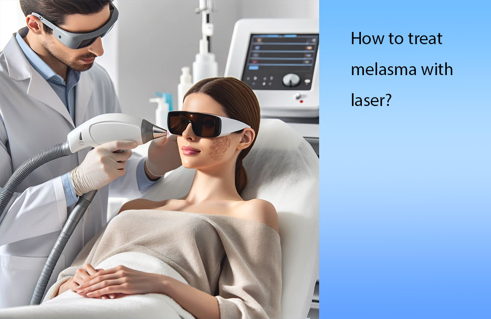 How-to-treat-melasma-with-laser