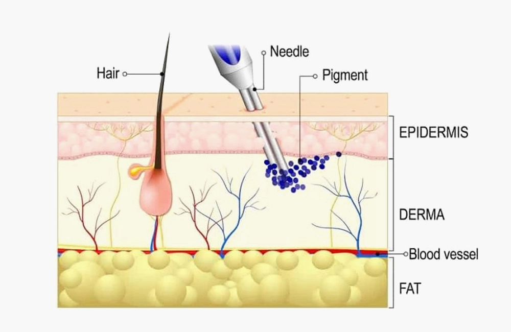 Mechanism of Tattoos