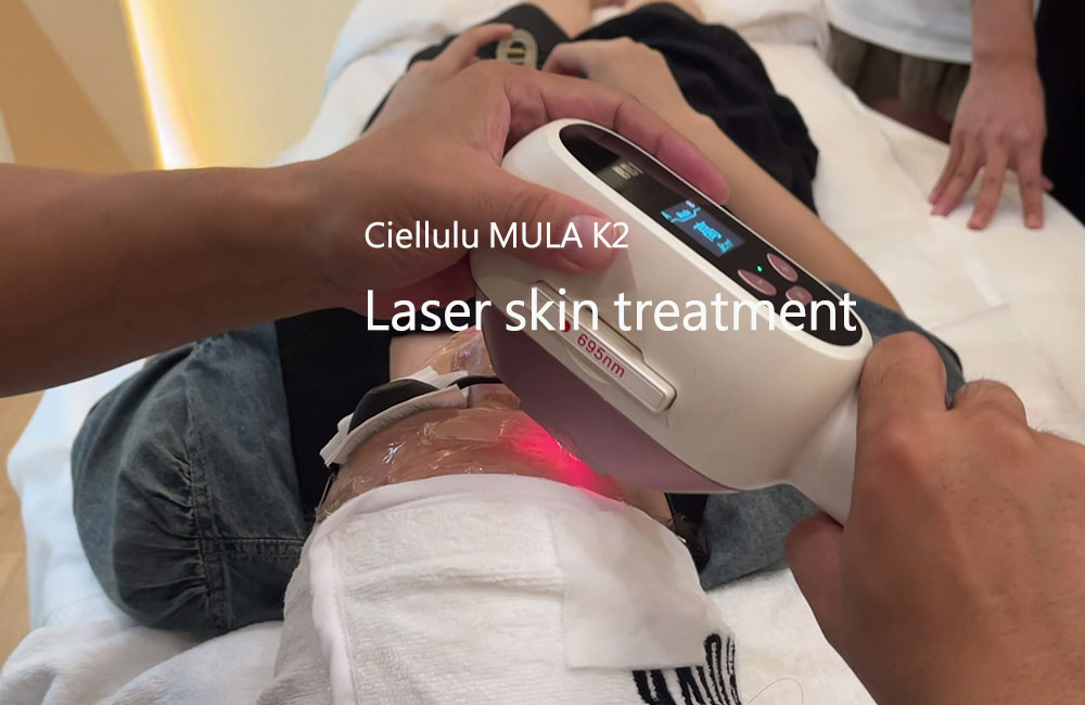 mula-k2-laser-skin-treatment