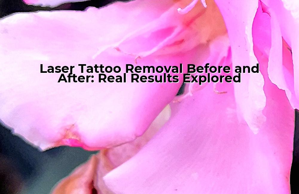 laser-tattoo-removal-before-and-after-real-results-explored