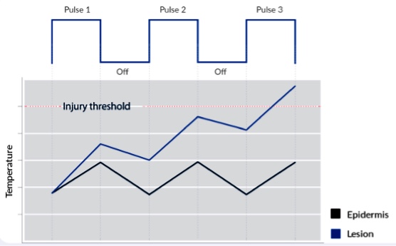 k2-waveform-diagram k2 waveform diagram