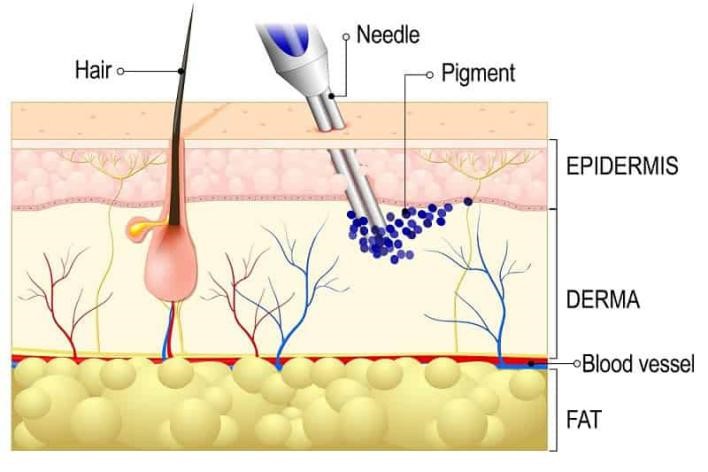 Mechanism of Tattoos