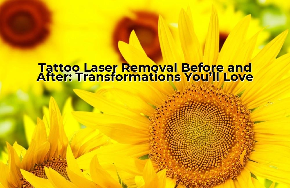 tattoo-laser-removal-before-and-after-transformations-youll-love