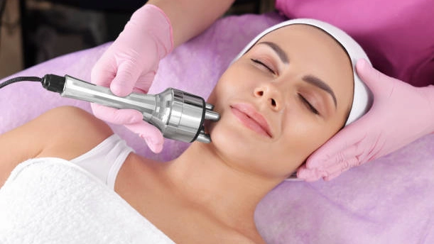 IPL laser for rosacea targets redness and broken capillaries, reducing visible symptoms of the condition.