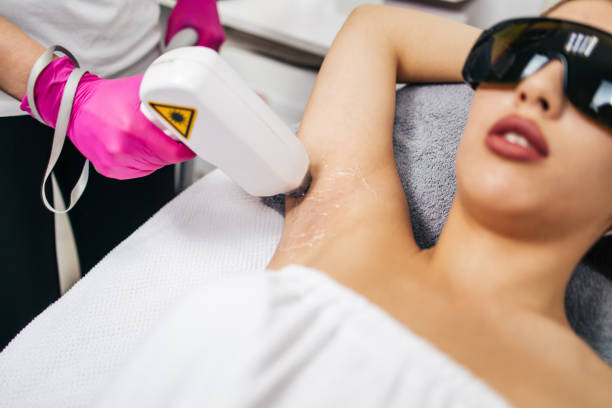 Professional laser hair removal equipment in use on a client's underarm.