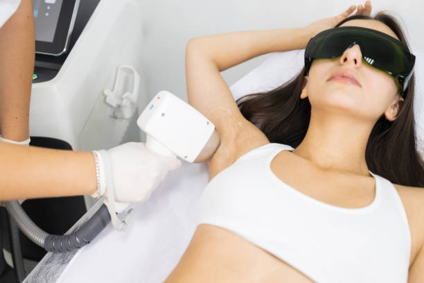 A woman receives a hair removal laser treatment on her underarm.