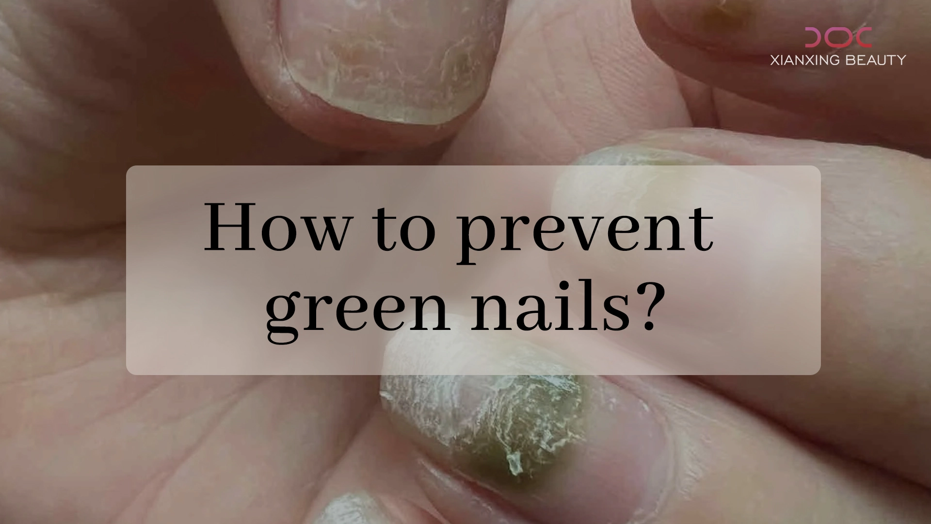 how to prevent green nails