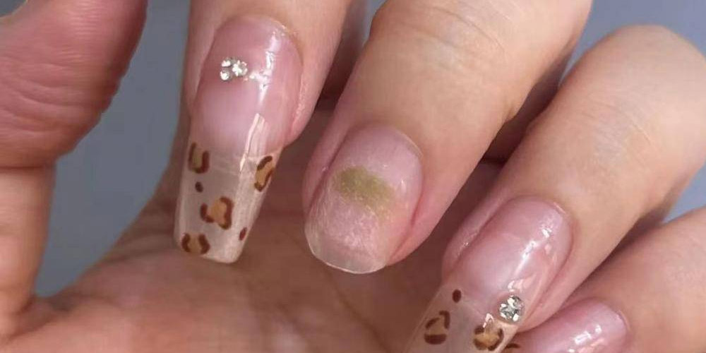 what is green nails?