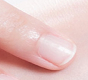 easy nail removal